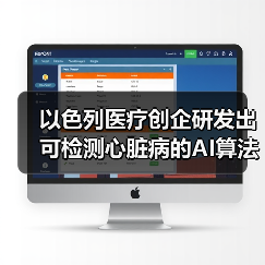以色列医疗创企研发出可检测心脏病的AI算法,已获FDA批准(图2) 以色列医疗创企研发出可检测心脏病的AI算法,已获FDA批准(图2)
