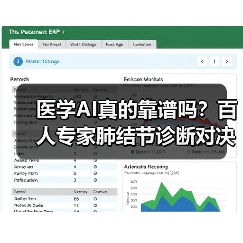 医学AI真的靠谱吗?百人专家肺结节诊断对决(图3) 医学AI真的靠谱吗?百人专家肺结节诊断对决(图3)