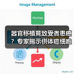 器官移植竟致受者患癌?专家揭示供体癌细胞潜伏风险(图2) 器官移植竟致受者患癌?专家揭示供体癌细胞潜伏风险(图2)