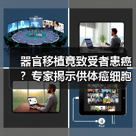器官移植竟致受者患癌?专家揭示供体癌细胞潜伏风险(图3) 器官移植竟致受者患癌?专家揭示供体癌细胞潜伏风险(图3)