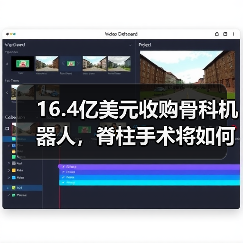 16.4亿美元收购骨科机器人,脊柱手术将如何变革?(图1) 16.4亿美元收购骨科机器人,脊柱手术将如何变革?(图1)