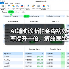 AI辅助诊断帕金森病效率提升十倍，解放医生负担（图1）